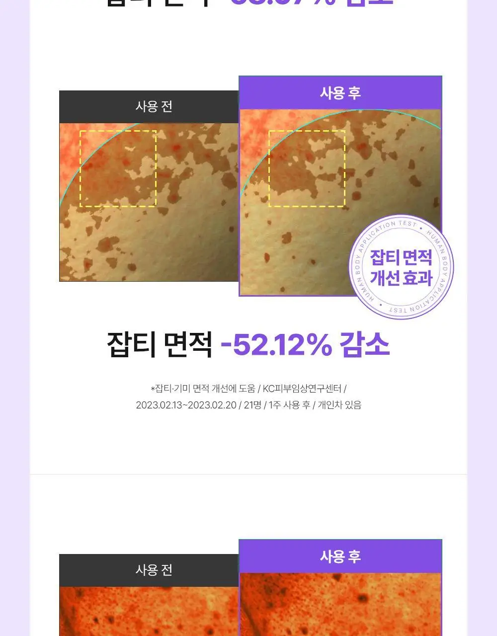 [잡티미백케어] 성분에디터 머루포도 비타 C 잡티크림 50g 상세페이지 10